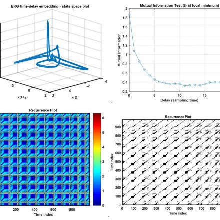 Using RQA and Neural Networks to Analyze Complex Time Series Using RQA and Neural Networks to Analyze Complex Time Series